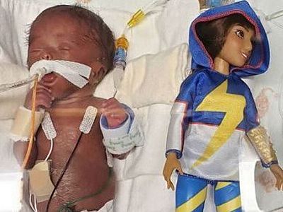 Baby Kallie born smaller than a Barbie doll weighing 13oz goes home after 150 days