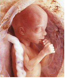 NI Secretary of State suggests abortion is a necessity during the Coronavirus Pandemic