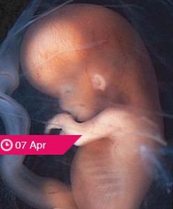 PRESS RELEASE: Precious Life slam Michelle O'Neill's 'outrageous' push for dangerous and deadly DIY home abortions in Northern Ireland