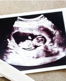 PR: Precious Life call on people of Derry to 'take back their vote' for pro-abortion Colum Eastwood MP