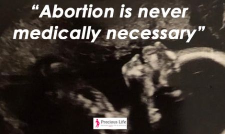 US: 30,000 Doctors say abortion is never medically necessary to save a mother's life