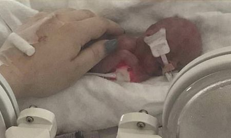 Premature baby girl given 5% chance of survival defies the odds