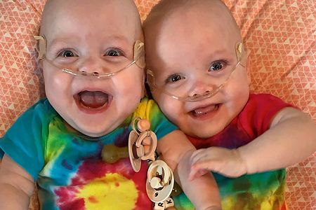 The world's most premature twins, born in Iowa, defy the odds and turn 1