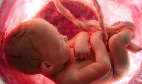 Press Release - Precious Life call for MLAs to Urgently Repeal