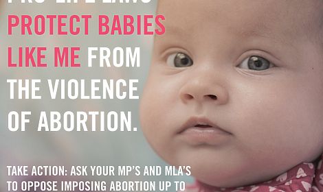 Does your MP or MLA support the right to life for all? Contact them TODAY