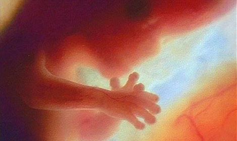 Irish Abortion Bill passes in Senate